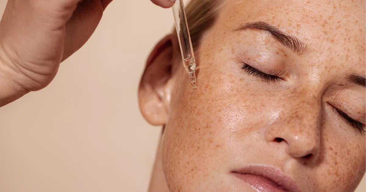 Woman applying over-the-counter hyaluronic acid treatment.